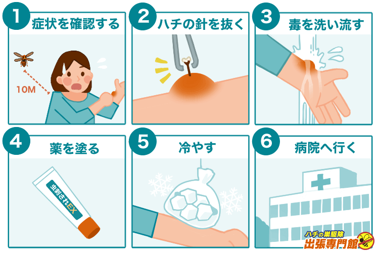 刺されたらすぐにその場を離れて、ハチの針を抜き、水で流し、薬をぬって冷やしながら病院に行きましょう