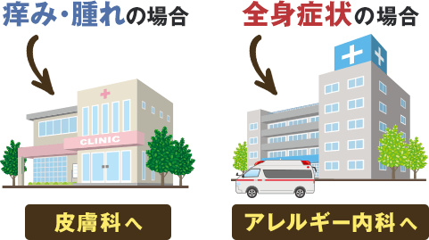 痒み・腫れの場合皮膚科へ 全身症状の場合アレルギー内科へ