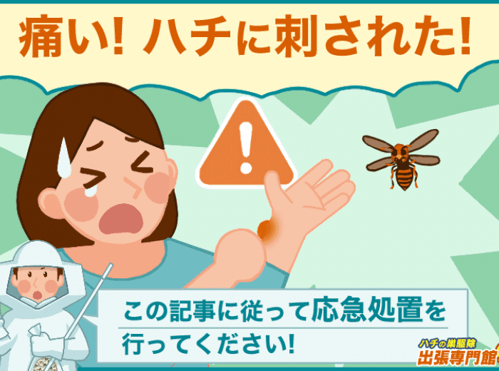 1分で理解できる ハチに刺された時の応急処置 21年最新版